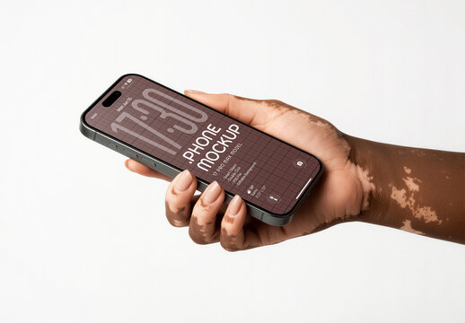 Inclusive Vitiligo Hand Phone Mockup On Editable Background