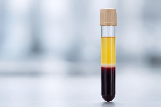 Separated Blood Sample Tube In Clean Laboratory Macro