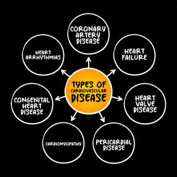 Types of cardiovascular disease mind map displaying coronary artery disease, heart arrhythmias, failure, valve, congenital heart disease, cardiomyopathy, and pericardial disease categories for medical