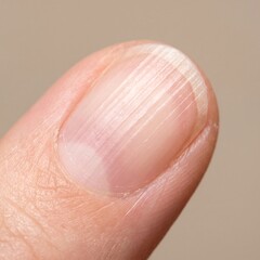 Fototapeta premium Nail Health: Extreme Macro Close-Up of a Fingernail Showing Distinct Vertical Ridges