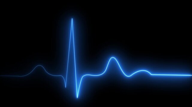 Electrocardiogram graph displaying heartbeat rhythm on digital screen with grid pattern in medical monitoring environment.4k video