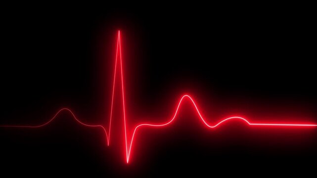 Electrocardiogram graph displaying heartbeat rhythm on digital screen with grid pattern in medical monitoring environment.4k video