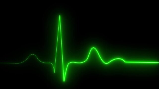 Electrocardiogram graph displaying heartbeat rhythm on digital screen with grid pattern in medical monitoring environment.4k video