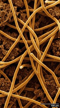 Mycelial networks of soil fungi showing dense cylindrical hyphae with visible septa, growing through organic aggregates, demonstrating the underground world wide web system.