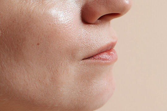 Close up skin texture with natural pores, gentle light, soft lip and nose profile, neutral background conveying calm and realistic skincare detail