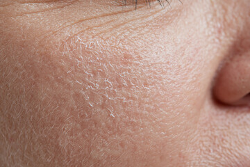 Fototapeta premium Dry facial skin close up showing slight flaky texture and fine facial hair with visible pores and wrinkle lines conveying natural aged skin detail