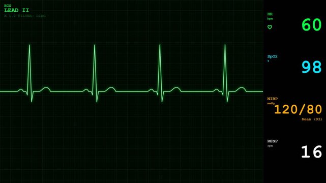 Heart rate monitor displaying patient vital signs with glowing green ecg wave animation