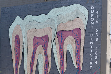 Obraz premium wall mural featuring a cross-section illustration of teeth outside Dupont Dentistry located at 196 Dupont St, Toronto
