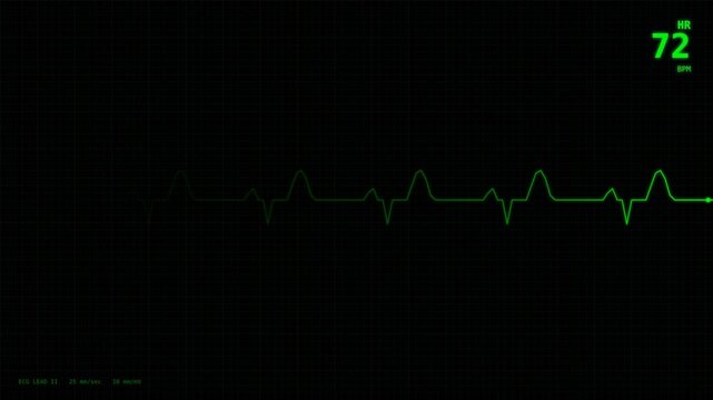 Motion health monitor displaying real-time heart rate and vital signs in a clinical setting.
