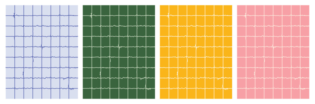 Set of four colorful electroencephalogram or eeg brain wave charts on grid backgrounds, representing medical diagnostic testing or neurological data analysis