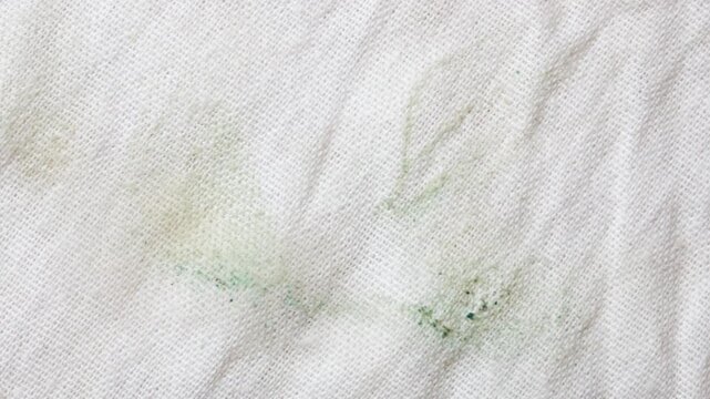 Dirty fabric with a green stain. Texture of stained fabric, washed,animation