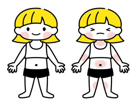 【医療・保育】湿疹（アトピー）の出ている女の子のイラスト