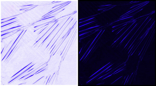 Microscopic view of muscle fibers, blue fluorescent skeletal muscle tissue under microscope, biological cellular structure research
