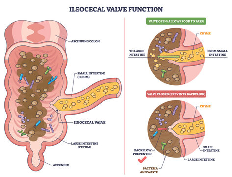 Ileocecal valve function shown with small intestine, large intestine, and valve illustrating one-way flow of chyme and prevention of backflow. Outline diagram