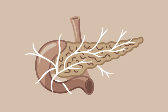Medical illustration of the human pancreas and its relationship with the duodenum and surrounding blood vessels on a neutral background.