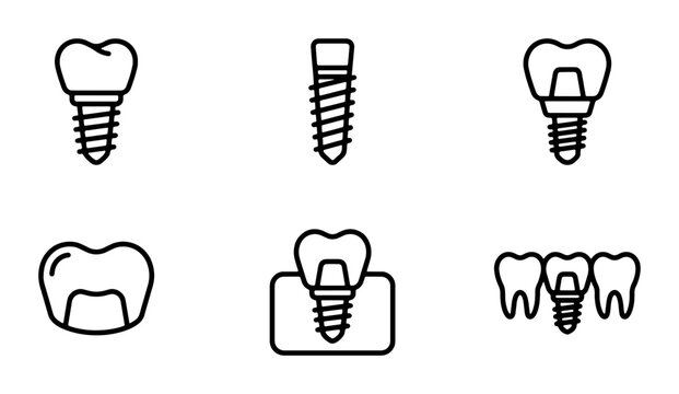 Dental Implant Icons, Tooth Replacement Vector Set, Oral Surgery and Dentistry Graphics, Medical Health Care Line Art Collection