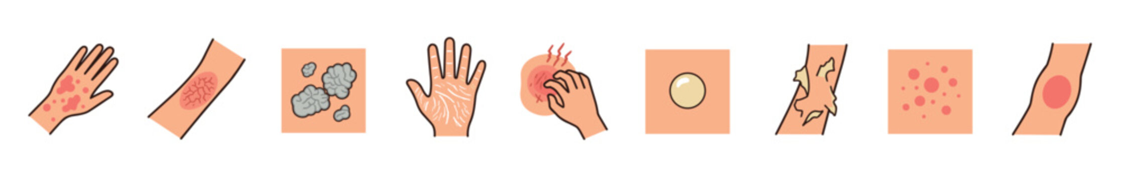 Various skin conditions symptoms illustrated in a medical diagram showing common dermatological issues like rashes, eczema, psoriasis, blisters, and dry, itchy skin.
