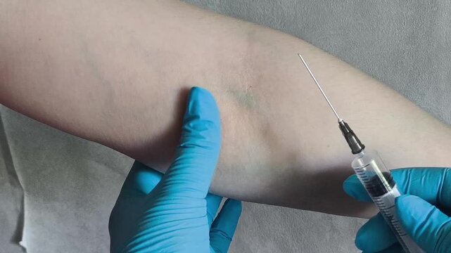 Doctor examining, touching vein on arm and holding a syringe before IV injection, venipuncture, hospital treatment and clinical procedure.