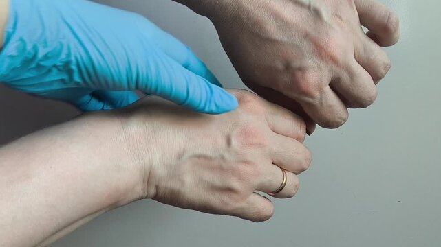 Healthcare professional examining veins on patient's arm, vascular examination, vein assessment and cardiovascular health concept.