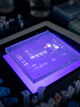 DNA gel electrophoresis bands glowing under ultraviolet light in a scientific laboratory transilluminator