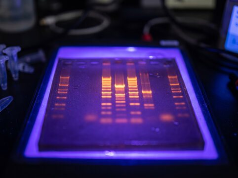 DNA gel electrophoresis illuminated by ultraviolet light on a transilluminator in a molecular biology laboratory.