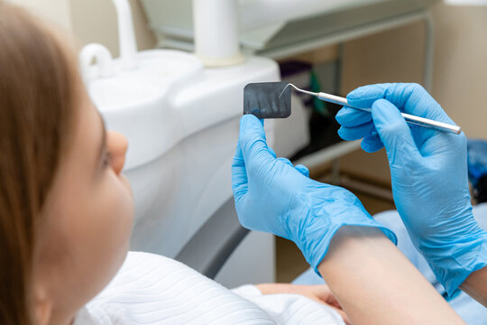 Dentist holding dental X-ray film while examining young patient's teeth in a modern dental clinic. baby teeth, the concept of pediatric dentistry, dental treatment.