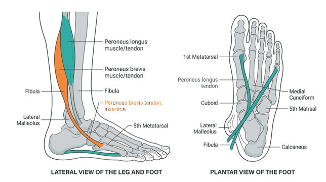 Anatomy of the Leg and Foot: Peroneal Muscles and Tendons