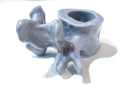 Anatomical human vertebra printed on 3D printer from liquid resin isolated on white background. Object created using photopolymer resin. SLA technology Stereolithography. Additive modern manufacturing