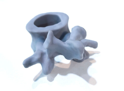 Anatomical human vertebra printed on 3D printer from liquid resin isolated on white background. Object created using photopolymer resin. SLA technology Stereolithography. Additive modern manufacturing
