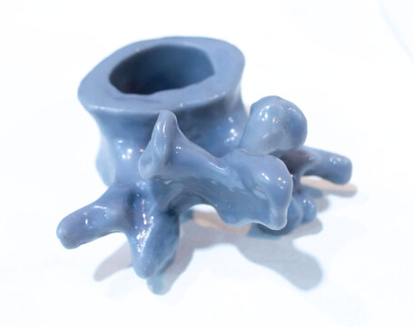 Anatomical human vertebra printed on 3D printer from liquid resin isolated on white background. Object created using photopolymer resin. SLA technology Stereolithography. Additive modern manufacturing