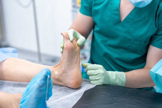 Podiatrist examining patient foot for bunion surgery