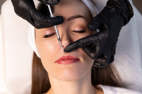 Hyaluronic acid filler. Closeup portrait of young woman with syringe near her lips during cosmetology therapy, injecting in beauty salon. Making lips, modern procedures, lifting, rejuvenation, beauty.