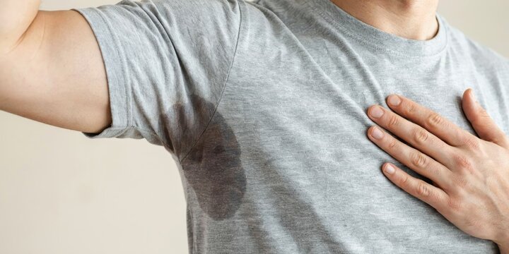 Man with hyperhidrosis sweating profusely under armpit, excessive sweating problem.