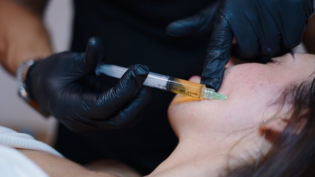 Cosmetic doctor performing a platelet rich plasma facial treatment