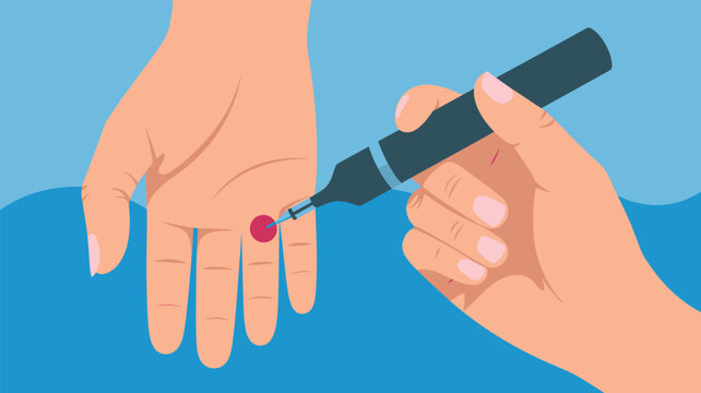 Hands performing a finger prick blood test using a lancing device for glucose monitoring