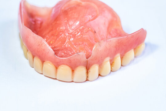 
Old Complete Denture with Cracked Acrylic Base Isolated on White Background