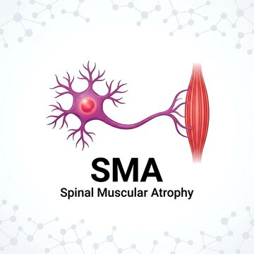 Spinal muscular atrophy visual showing motor neuron connecting to muscle fiber health awareness concept illustration.