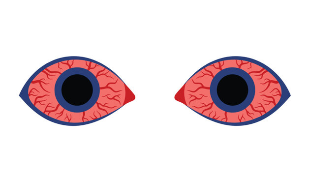 Close up vector illustration of a pair of bloodshot eyes with prominent red veins on a plain white background.