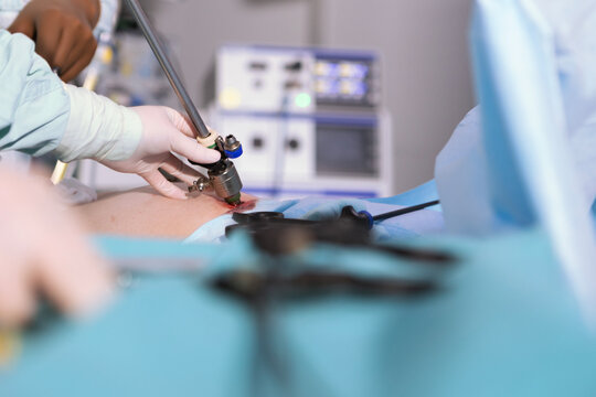 The surgeon's holing the instrument in abdomen of patient. The surgeon's doing laparoscopic surgery in the operating room. Minimally invasive surgery