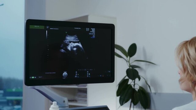 Doctor viewing fetal ultrasound scan on monitor during prenatal examination