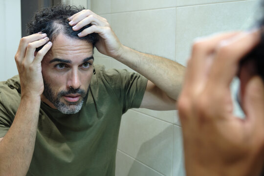 Man examining receding hairline and bald spot, expressing concern about hair regrowth