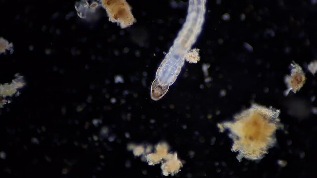 Transparent aquatic larva of Biting Midge under darkfield microscopy 