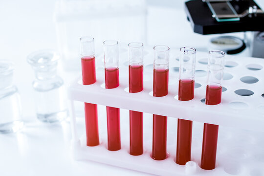 Medical equipment blood test in laboratory no one
