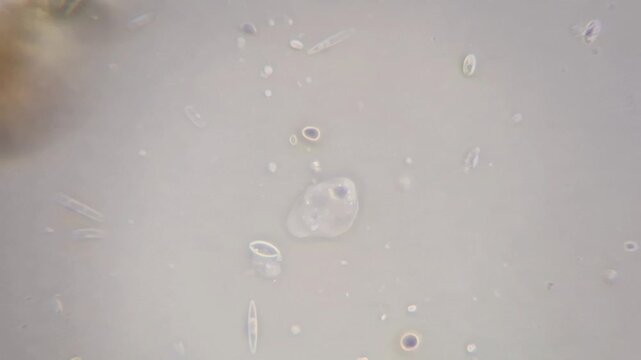 ​Real microscope footage of a moving amoeba microorganism