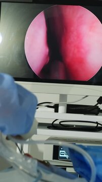 Laparoscopic instruments inside surgical operation shown on screen closeup. Surgeons examine patient nose with arthroscope in hospital vertical shot
