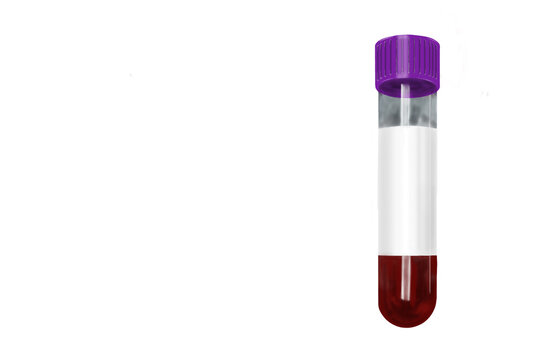 Purple cap EDTA blood collection tube with blood sample isolated on transparent background. High-quality PNG medical laboratory illustration suitable for hematology, complete blood count testing, heal