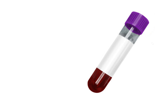 Purple cap EDTA blood collection tube with blood sample isolated on transparent background. High-quality PNG medical laboratory illustration suitable for hematology, complete blood count testing, heal