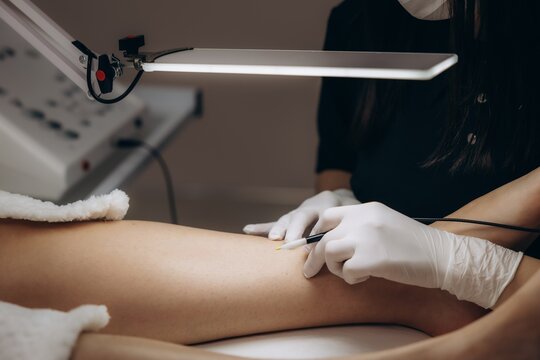 Aesthetician performing electrolysis hair removal treatment on leg