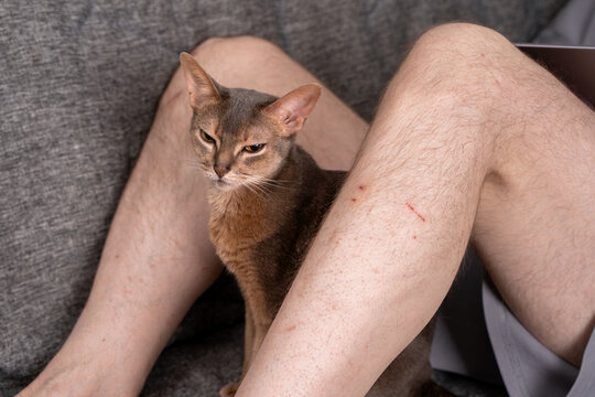 Abyssinian blue cat looking angry sitting near scratched male owner leg on sofa. Concept of aggressive pet behavior, cat attitude problems and negative experience of domestic animal ownership