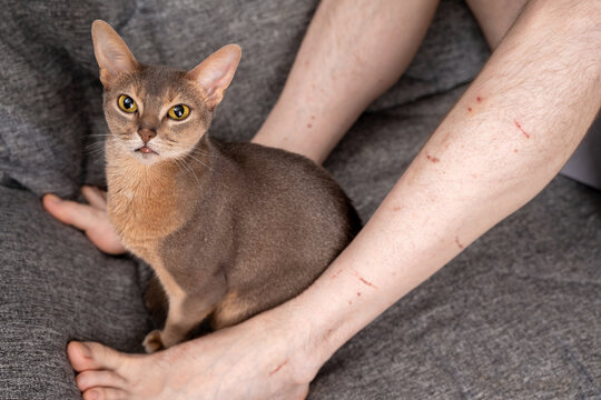 Cute abyssinian blue cat sitting near scratched male owner leg with visible wounds on skin. Concept of pet ownership challenges, aggressive behavior problem and domestic animal related injury